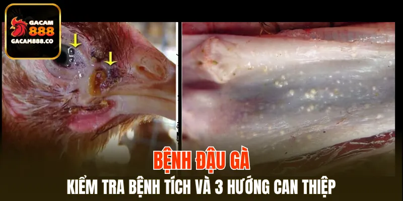 Bệnh Đậu Gà